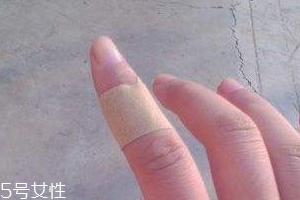 創(chuàng)可貼可以消腫嗎？創(chuàng)可貼有消腫功效嗎？