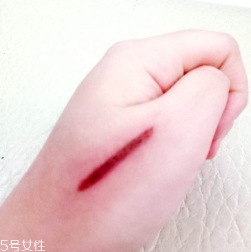 創(chuàng)可貼和肉連著怎么辦？創(chuàng)可貼連著肉怎么處理？