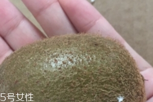 綠心獼猴桃含葉酸嗎？綠心獼猴桃里面有葉酸嗎？