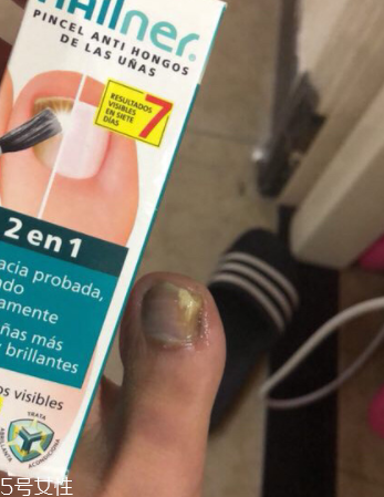 灰甲清有副作用嗎？灰甲清有哪些副作用？
