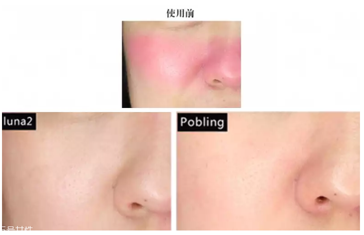 pobling和luna哪個(gè)好 pobling震動潔面儀和luna mini2對比評測