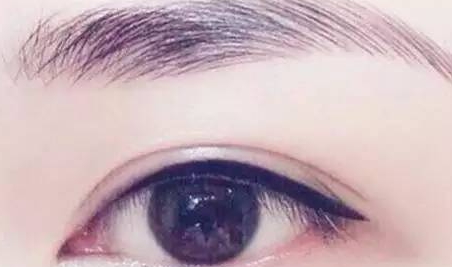 提眉和雙眼皮一起做嗎？提眉和雙眼皮要隔開多久