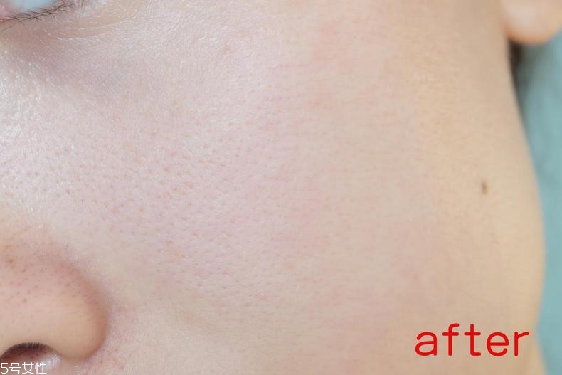 radha beauty vc精華白天能用嗎？敏感肌能用嗎？