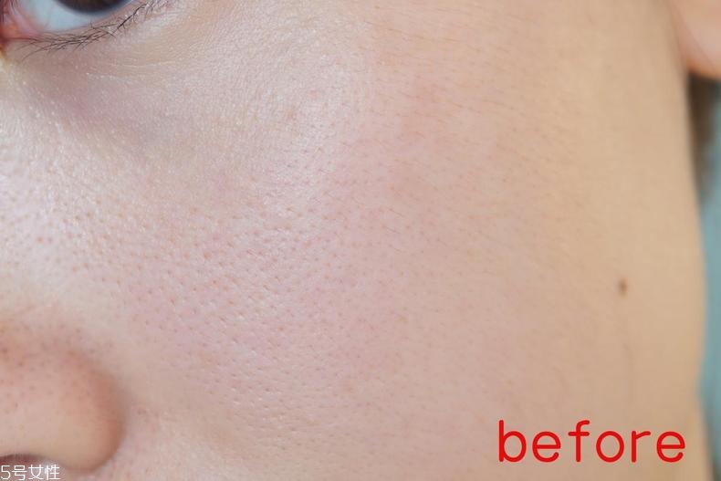 radha beauty vc精華白天能用嗎？敏感肌能用嗎？