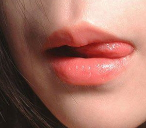 兔唇修復(fù)要多少錢？兔唇修復(fù)風(fēng)險(xiǎn)大嗎