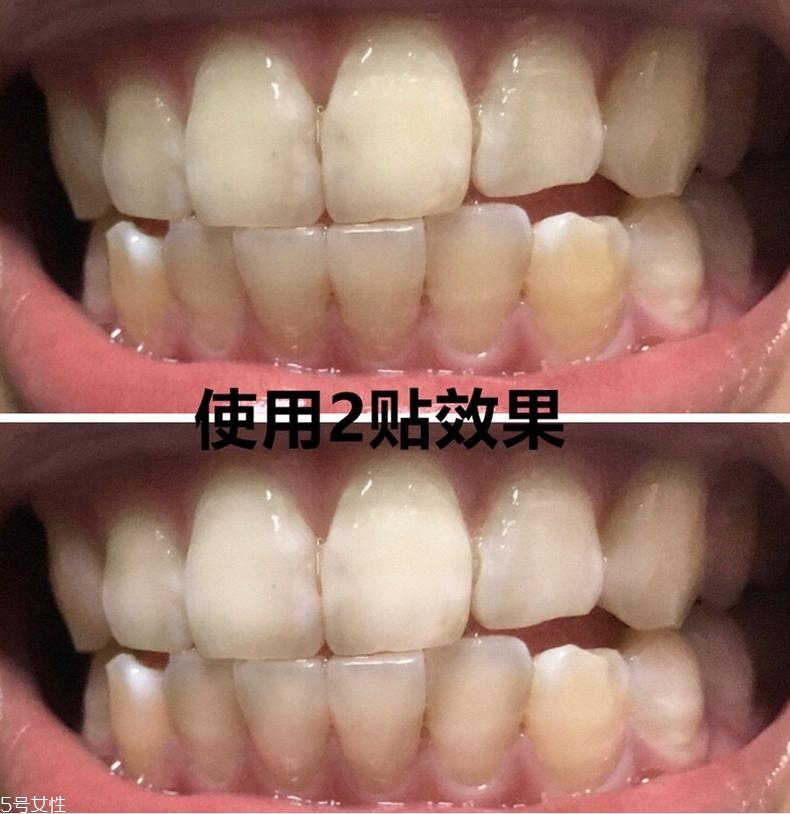 佳潔士美白牙貼貼多久有效？佳潔士美白牙貼使用感受