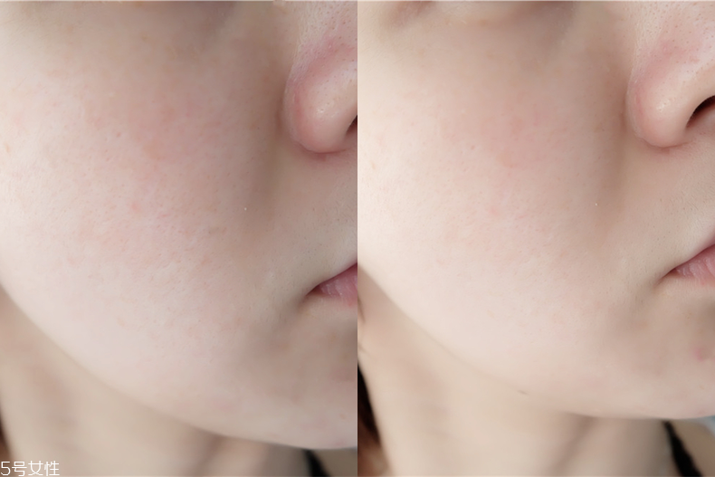 臺(tái)塑生醫(yī)產(chǎn)品不合格嗎 很安心的醫(yī)美級(jí)面膜 臺(tái)塑生醫(yī)產(chǎn)品不合格嗎 很安心的醫(yī)美級(jí)面膜