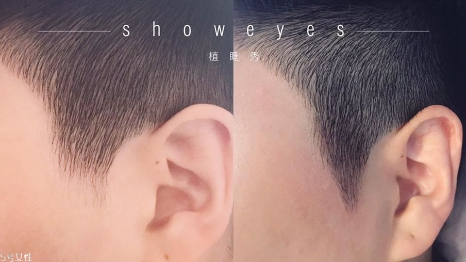 發(fā)量少怎么增加發(fā)量 禿發(fā)女孩必學發(fā)量激増6招 發(fā)量少怎么增加發(fā)量 禿發(fā)女孩必學發(fā)量激増6招