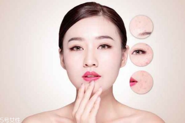 涂完粉底毛孔里都是白色點(diǎn)點(diǎn) 化妝時(shí)毛孔里都是粉 涂完粉底毛孔里都是白色點(diǎn)點(diǎn) 化妝時(shí)毛孔里都是粉