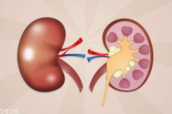 腎結(jié)石平常注意什么 腎結(jié)石飲食禁忌 腎結(jié)石平常注意什么 腎結(jié)石飲食禁忌