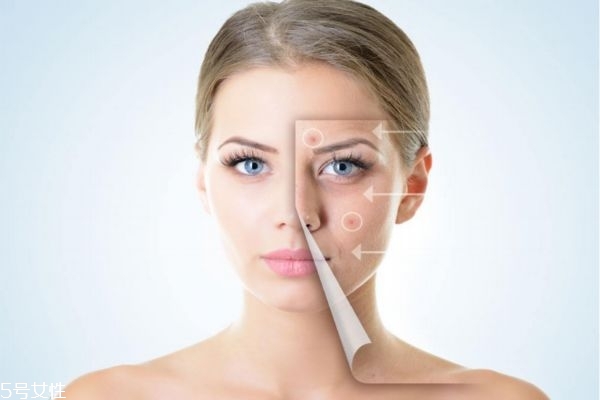 太陽曬斑怎么去除 怎么去除曬斑 太陽曬斑怎么去除 怎么去除曬斑