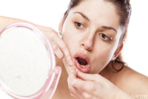 經(jīng)期如何預(yù)防長痘 經(jīng)期長痘的注意事項(xiàng) 經(jīng)期如何預(yù)防長痘 經(jīng)期長痘的注意事項(xiàng)