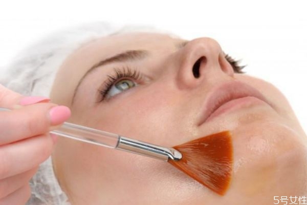 怎么去除臉上的青春痘 青春痘去掉小妙招 怎么去除臉上的青春痘 青春痘去掉小妙招