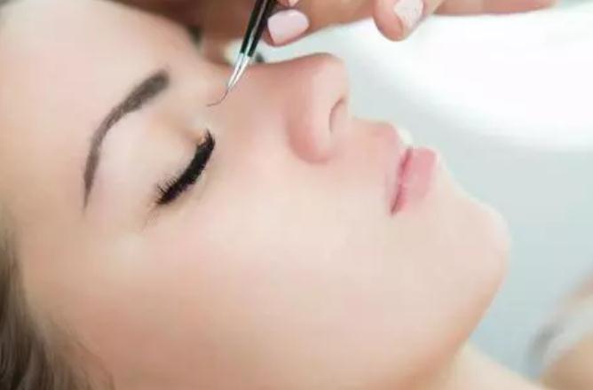 種睫毛眼皮過(guò)敏紅腫癢怎么辦 種睫毛眼皮腫了幾天能好 種睫毛眼皮過(guò)敏紅腫癢怎么辦 種睫毛眼皮腫了幾天能好