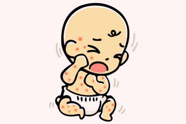 嬰兒濕疹是什么原因引起的起的 嬰兒濕疹怎么護(hù)理好得快 嬰兒濕疹是什么原因引起的起的 嬰兒濕疹怎么護(hù)理好得快