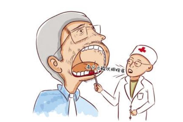 口腔潰瘍有什么土方法 口腔潰瘍有什么偏方 口腔潰瘍有什么土方法 口腔潰瘍有什么偏方