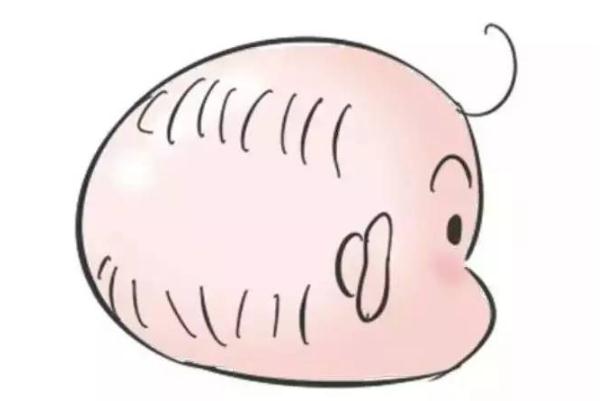 嬰兒枕禿是佝僂病嗎 嬰兒枕禿會(huì)自己好嗎 嬰兒枕禿是佝僂病嗎 嬰兒枕禿會(huì)自己好嗎