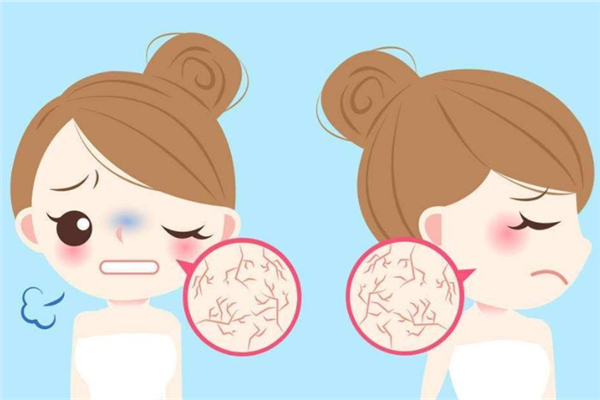 皮膚干燥的原因是什么 皮膚干燥會引起什么皮膚問題 皮膚干燥的原因是什么 皮膚干燥會引起什么皮膚問題