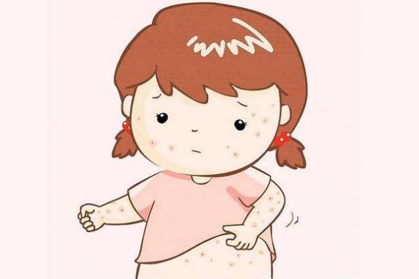 寶寶長(zhǎng)痱子可以吃蝦嗎 寶寶長(zhǎng)痱子可以打疫苗嗎 寶寶長(zhǎng)痱子可以吃蝦嗎 寶寶長(zhǎng)痱子可以打疫苗嗎