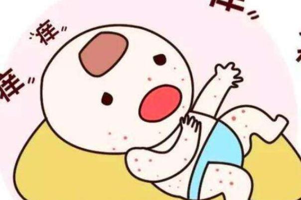 寶寶長(zhǎng)痱子可以吃蝦嗎 寶寶長(zhǎng)痱子可以打疫苗嗎 寶寶長(zhǎng)痱子可以吃蝦嗎 寶寶長(zhǎng)痱子可以打疫苗嗎