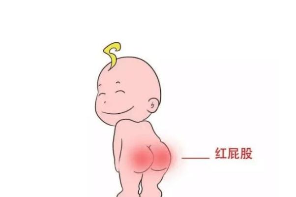 寶寶紅屁股是不是尿不濕造成 寶寶紅屁股是過敏癥狀嗎 寶寶紅屁股是不是尿不濕造成 寶寶紅屁股是過敏癥狀嗎