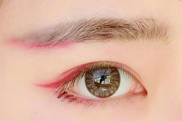 開眼角多久能恢復(fù)好 開眼角后怎么護理