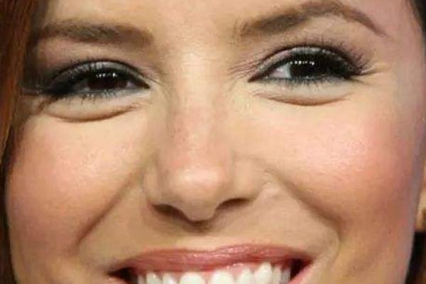 魚(yú)尾紋除皺針打一次能保持多久 魚(yú)尾紋除皺針有什么副作用 魚(yú)尾紋除皺針打一次能保持多久 魚(yú)尾紋除皺針有什么副作用