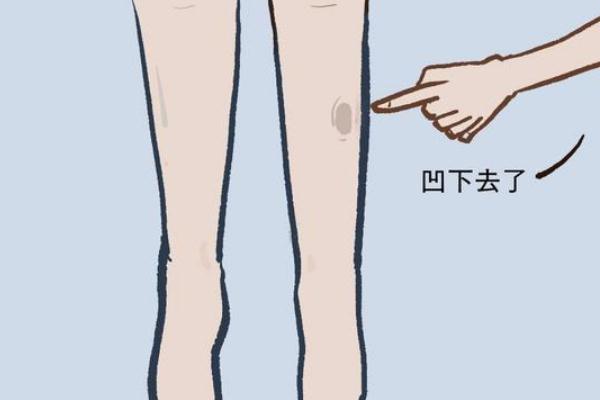 水腫是什么意思 過敏性水腫癥狀有哪些 水腫是什么意思 過敏性水腫癥狀有哪些