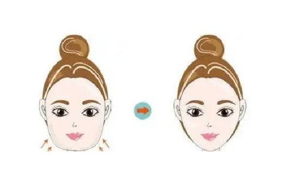 武漢面部整形哪里好 武漢面部整形要花多少錢 武漢面部整形哪里好 武漢面部整形要花多少錢