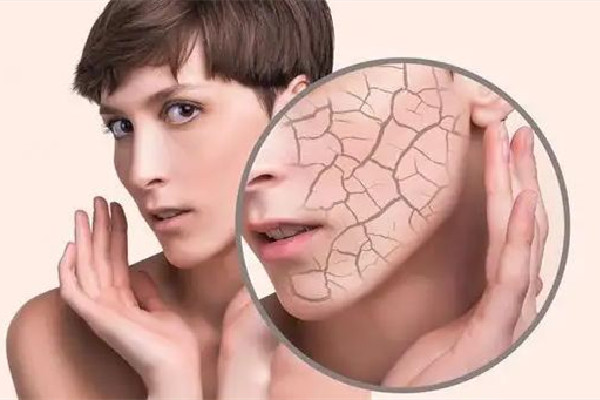 光谷天地SKINOGY顏可諾醫(yī)研護(hù)膚中心深層補(bǔ)水項(xiàng)目做得怎么樣 深層補(bǔ)水的好處 光谷天地SKINOGY顏可諾醫(yī)研護(hù)膚中心深層補(bǔ)水項(xiàng)目做得怎么樣 深層補(bǔ)水的好處