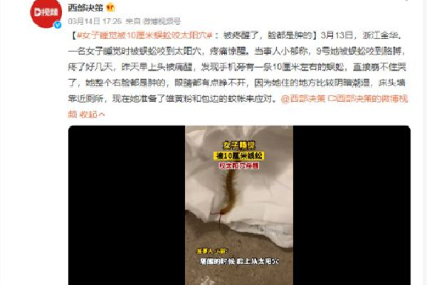 女子睡覺時(shí)被10厘米蜈蚣咬太陽(yáng)穴 被蜈蚣咬了會(huì)有生命危險(xiǎn)嗎